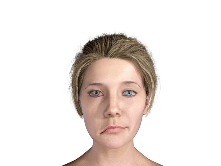 Facijalis